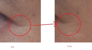 20110705-3ss.jpg
